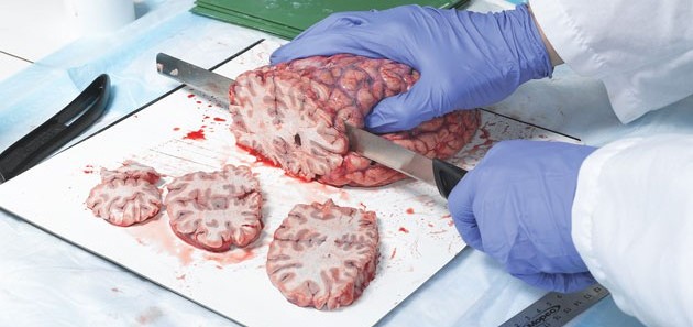 Human brain sliced
